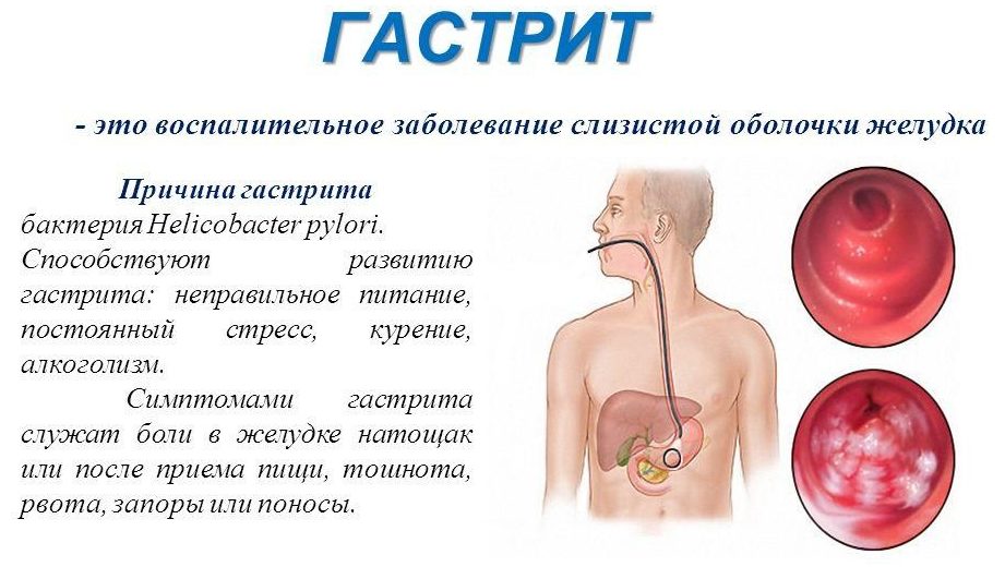 Рвота после приема пищи. Болит желудок после алкоголя.