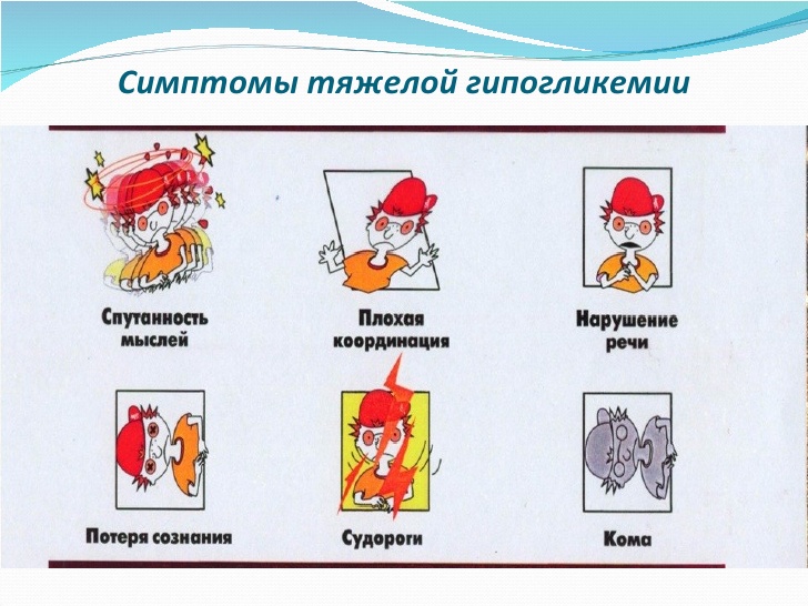 Что такое гипогликемия. Симптомы гипергликемии при сахарном диабете. Симптомы легкой гипогликемии. Признаки гипогликемия гипогликемической комы. Тяжелая гипогликемия.